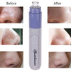 Facial Pore Cleanser Blackhead Vacuum Suction Remover(Blue)