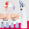 Face Pore Cleaner Blackhead Remover Vacuum Comedo Suction Diamond Dermabrasion Facial Cleaning Beauty Machine(Rose gold)