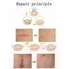 Organic silicone Gel Scar Therapy Patch  be Washed and Reused